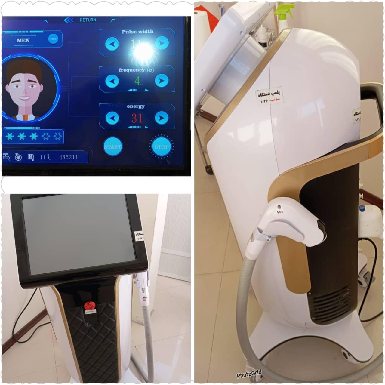 فروش دستگاه لیزر